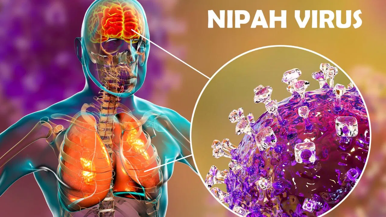 Nipah Virus Infection